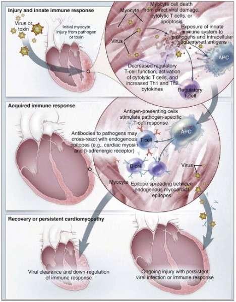FIGURE 70-2 Pathogenesis of myocarditis From