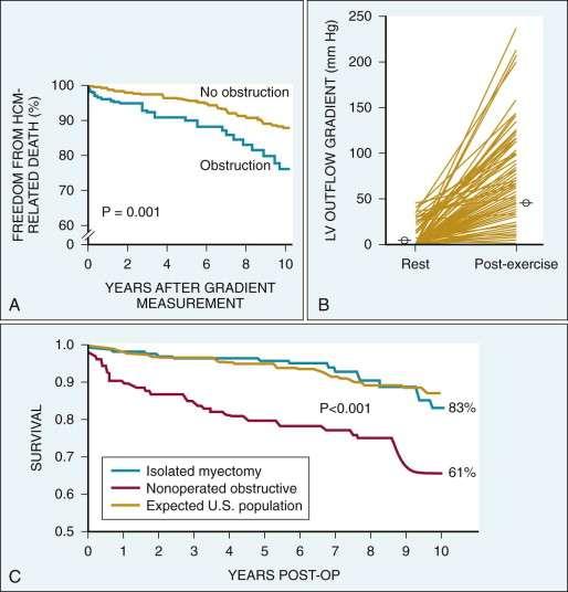 From Ommen SR, Maron BJ, Olivotto I, et al: Long-term effects of surgical septal myectomy on survival in patients with