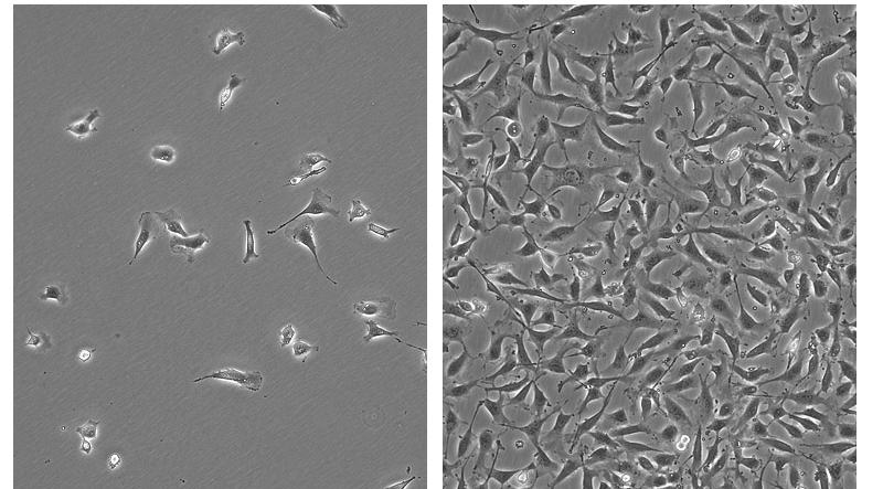 Слика 10. Фазно-контрасне микрофотографије ЕА.хy 926 ћелија у култури при малој и великој густини сађења ЕА.