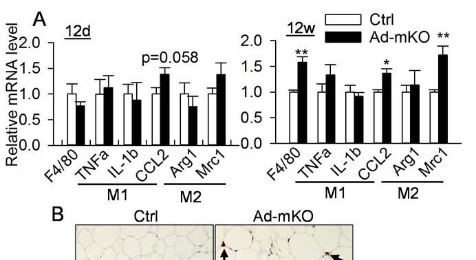 Supplementary Figure 4. Inflammation and ER stress in adipose tissue of Ad