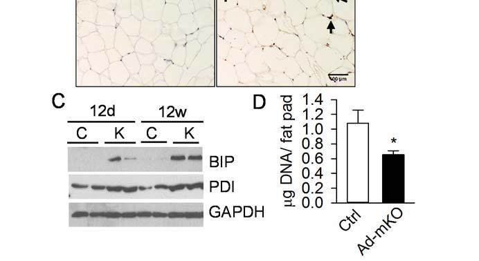 Representative immunohistochemical images of infiltrated macrophages stained with F4/80 (dark brown, arrow indicated) and counter-stained with hematoxylin in ewat of Ctrl and AdmKO