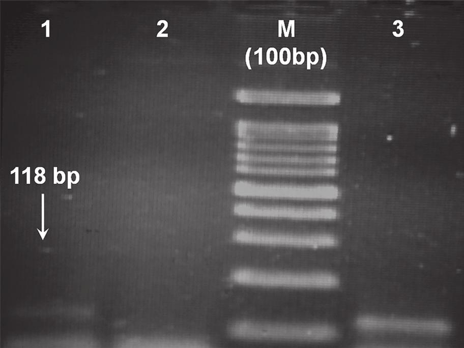 8S rrna و 18S rrna ژن از شده پرایمرطراحی جفت از چاهک خام سویا روغن از شده استخراج DNA 2 µl 2: شماره چاهک منفی کنترل شده(.