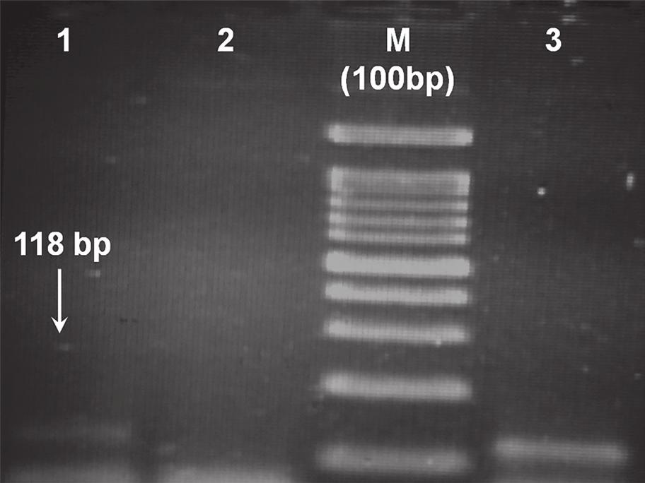 8S rrna و 18S rrna ژن از شده پرایمرطراحی جفت از چاهک خام سویا روغن از شده استخراج DNA 2 µl 2: شماره چاهک منفی کنترل شده(.