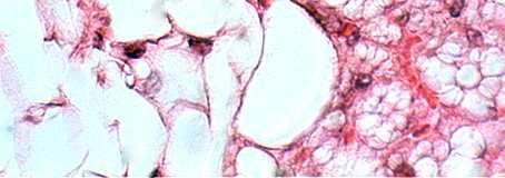 itrat državanje tjelesne topline Smeđe masno tkivo masne stanice (adipociti) imaju više masnih kapljica, veći broj mitohondrija koji sadrže željezo (smeđa boja), a tkivo je bolje prokrvljeno