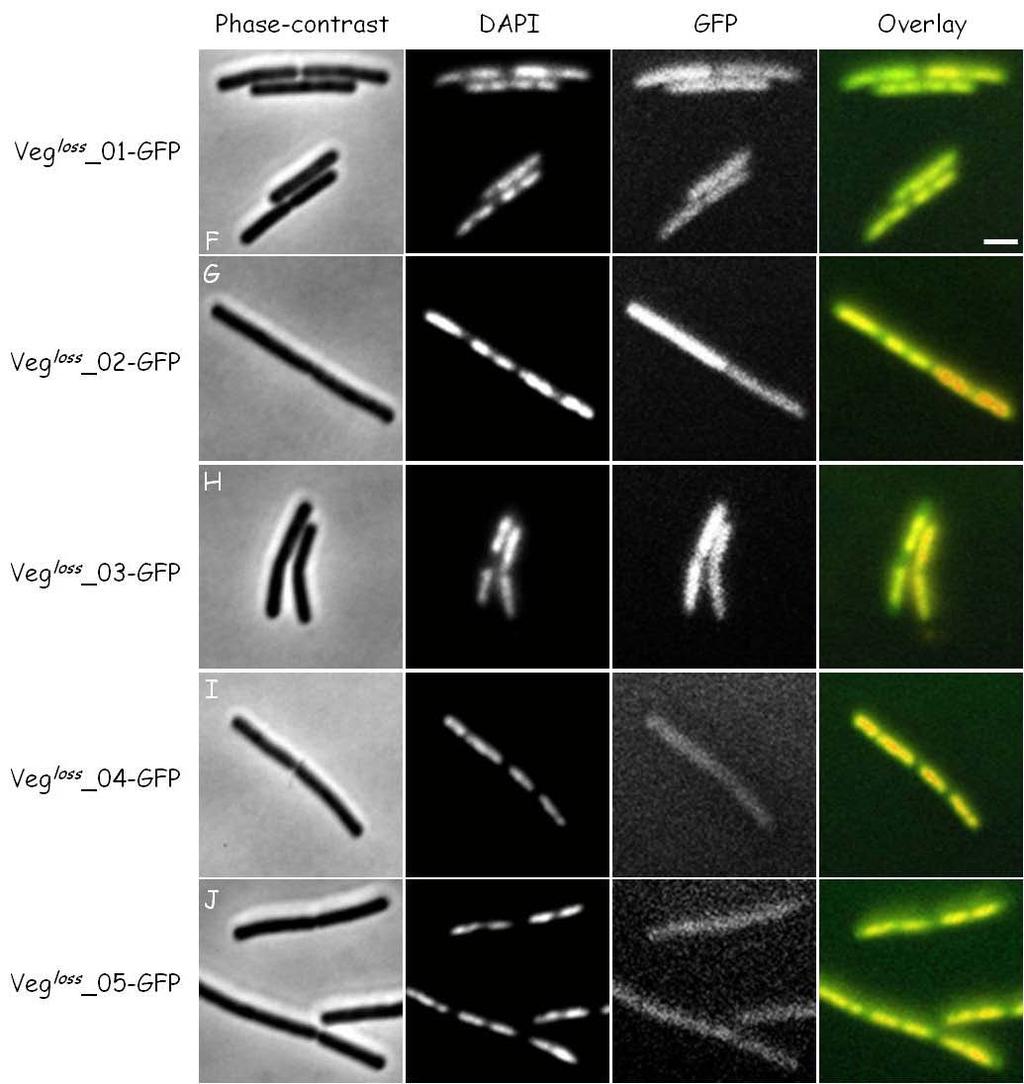 Figure 12. Localization of the Veg mutant proteins with GFP fusion. GFP strains were cultured to mid-logarithmic phase (OD 600 of 0.3-0.