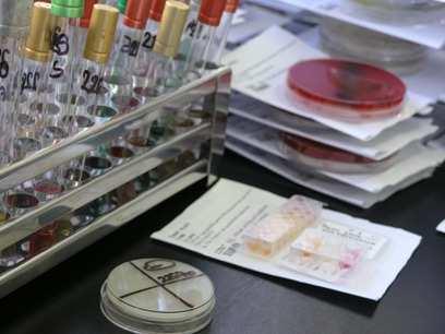 Primjerice, obrisak nazofarinksa se rijetko smatra optimalnim uzorkom za bilo koju bakterijsku infekciju susjednih struktura koje komuniciraju s nosnom sluznicom, kao što su sinusi ili srednje uho,