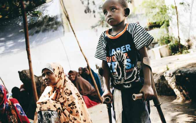 «ليبان» ا عوام يس تخدم ع ك ازتيه بعد فقده س اقه نتيجة انفجار قنبلة في مقديششو الصصومال.