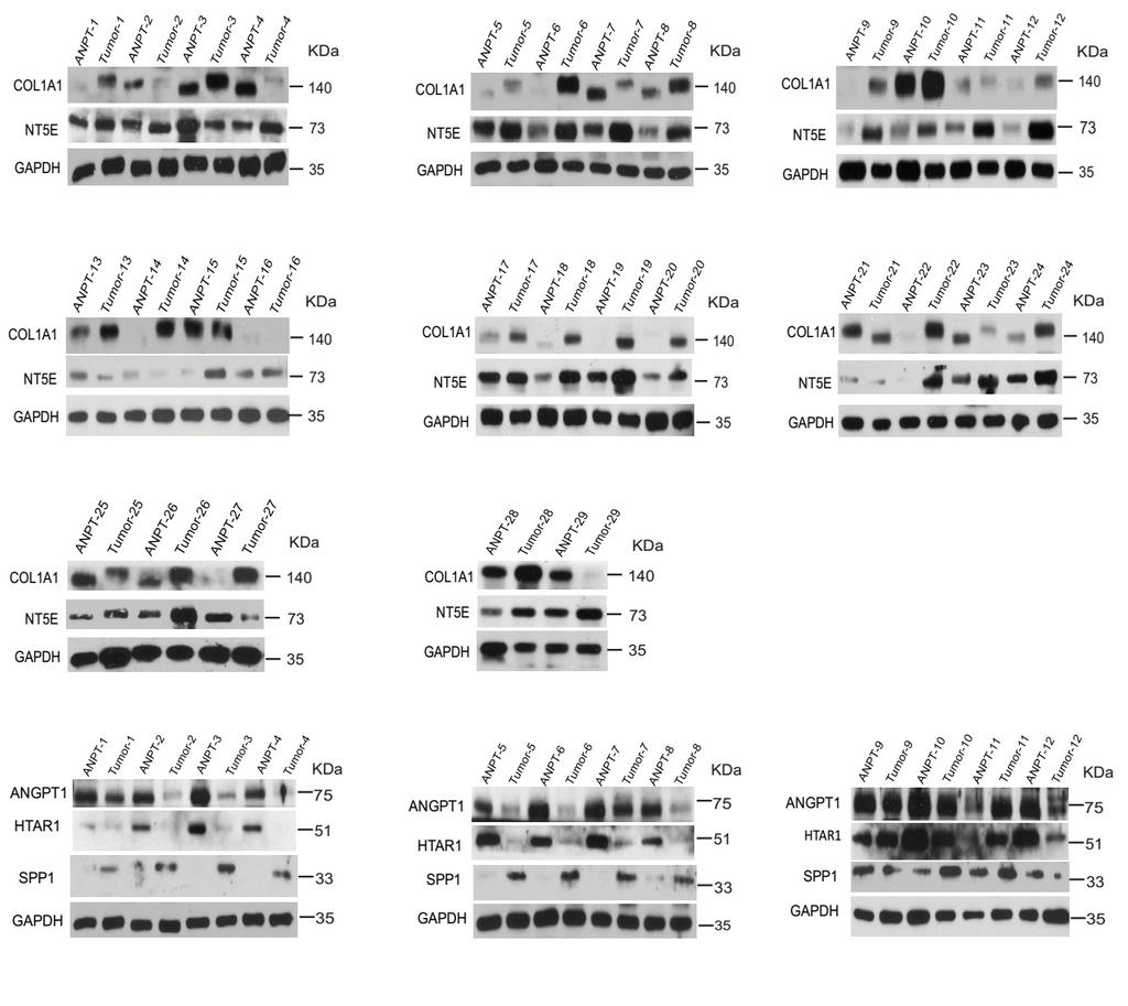 S10 of S29 Figure S11. Full-length blots of Figure 4.