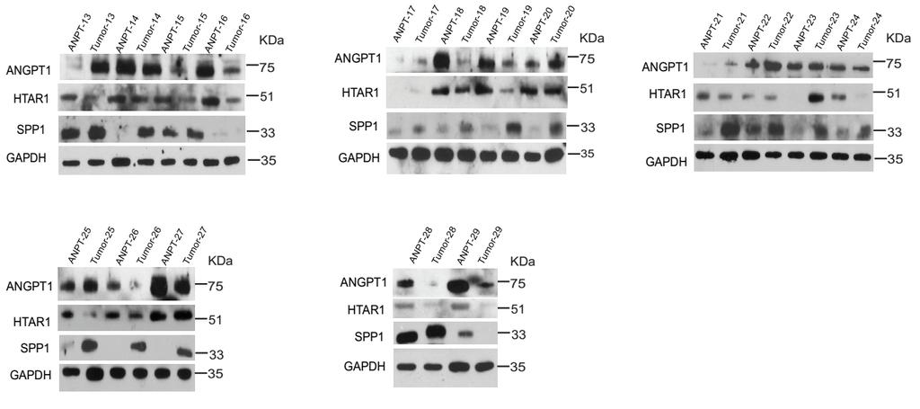COL1A1, NT5E, HTRA1 and ANGPT1 protein between 29