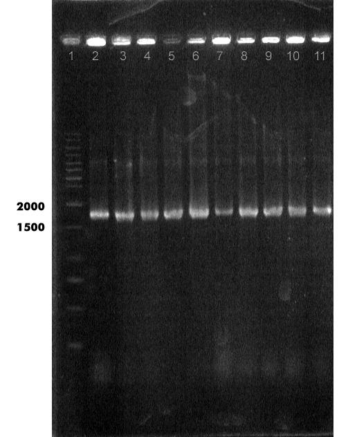 استفاده از دوآنزيم NdeI وHindII 6- بحث در اين طرح ابت دا RNA از محيط حاوي وي روس سرخك سوش واكسينال AIK-C كه روي سلولهاي ديپلوي يد انساني MRC-5 رشد كردهبودند استخراج شد.
