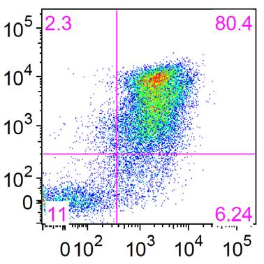 (a) Progressing tumor cells were analyzed for CD19 expression.
