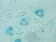 S11. Induction of premature