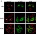15 PI3K / Akt / mtor PI3K / Akt / mtor 16 The higher the number of " " is, the more potent the inhibitor or activator is.