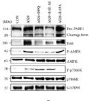 17 PI3K / Akt / mtor PI3K / Akt / mtor 18 A16275 PI3K-gamma inhibitor 1 A16276 SAR245409 (XL765, Voxtalisib) A16277 TGR-1202 mtor A16278 A16332 A16352 TGR-1202 hydrochloride IPI-549 AZD8835 The