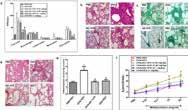 Protein Tyrosine Kinases 21 PI3K / Akt / mtor 22 A10507 KU-60019 Oncology Letters, 2016, 12(1), 295-300. KU-60019 purchased from Adooq KU-60019 is a potent and specific ATM inhibitor with IC50 of 6.