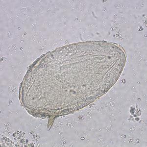 sigură metodă de dg Ecografie leziuni hepatice şi de tract genito-urinar Schistosoma mansoni.