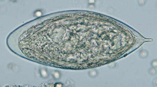 Schistosoma haematobium.
