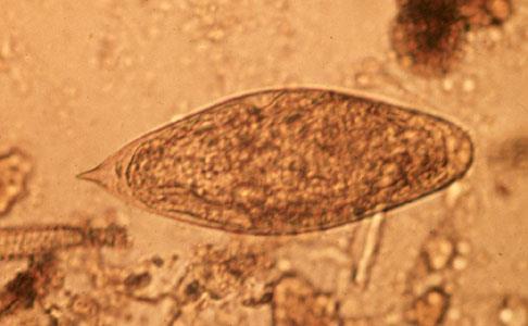 Schistosoma intercalatum. Ouă asemănătoare cu S.