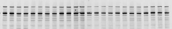 Figure 3 Control G219S Control G219S Donor 12 Donor 17 Donor