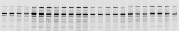 Donor 19 Donor 26 Donor 22 MLi-2: - - + + - - + + - - + + - -
