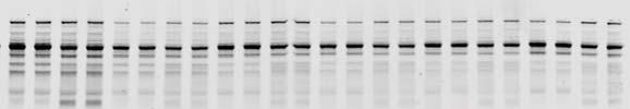 6 Donor 24 Donor 15 Donor 3 Donor 9 Donor 11 Donor 1 Donor 4