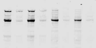 Donor 1 Donor 2 Donor 1 Donor 2 DIFP (.5 mm): + + + + PMSF (2.