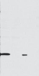 Supplementary Figure 1 Rab1 MJFF-total Rab1