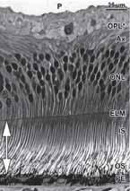 Preretinal Space Nerve Fiber Layer Ganglion Cell Layer Inner Plexiform Layer
