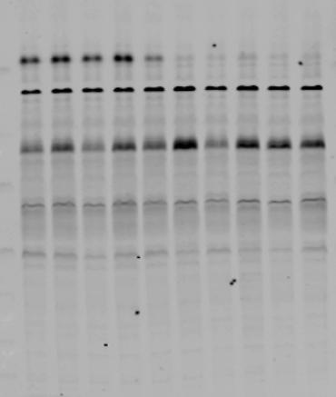 QUANTITATION 100 MJFF-pRab10 clone-2 MJF-21-83-4
