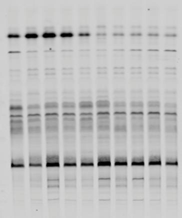 1 Relative prab10/gapdh signal 10 1 0.