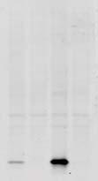 MJFF-pRab10 clone-1 25 Rab10 25 Rab8a 250 37 LRRK2 p-erk1/2 37 ERK1/2 37 GAPDH Immunoblot B Ctrl IPD Ctrl IPD Ctrl IPD Ctrl IPD Ctrl IPD 1 2 3 4 5 1 2 3 4 5 6 6 7 8 9 11 7 8 9 10