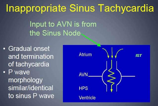 INAPPROPRIATE SINUS TACHYCARDIA a nonparoxysmal form of AT originating along the superior aspect of the crista terminalis (in the sinus node region ) rate > 100 bpm during the day,
