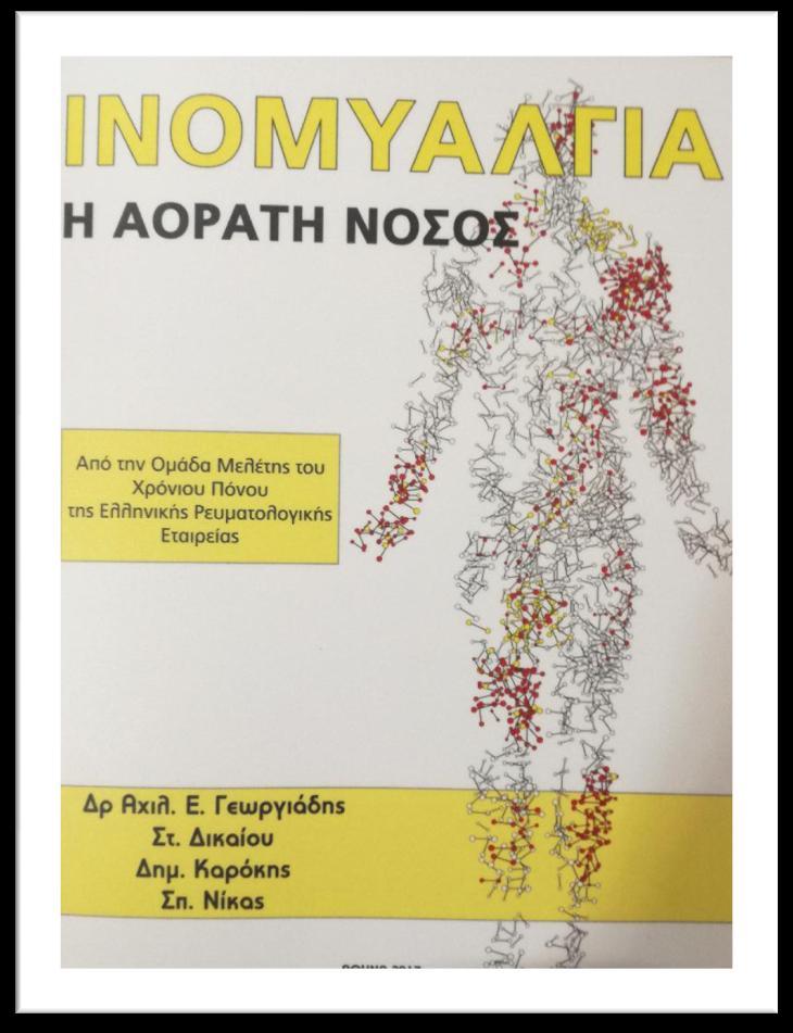 Ο συνδυασμός φαρμάκων fluoxetin (SSRI) με cyclobenzaprine (μυοχαλαρωτικό), όπου σε σχέση με την μονοθεραπεία με cyclobenzaprine, φάνηκε επιπλέον βελτίωση στην ένταση του πόνου, στον αριθμό των