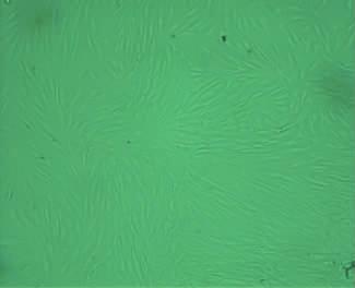 6 micrornas 543 Fig 1 Morphological observation of ligament fibroblast under the light microscope 10 7 d 14 BCIP / NBT 7 d 14 d Fig 2 β- Runx2 14 d Fig 3 β- Fig 2 Effects