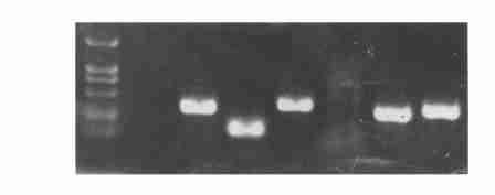 were reamplified by PCR and were resolved on 1 2 % agarose gel M:DNA marker ; 1 and 5 : no bands indicate unsuccessful clones ; 2 3 4 6 and 7 are successful clones ; 7 : ed1 fragment is indicated by