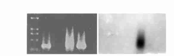 6 : DDRT2PCR 731 Fig 4 Results of reverse Northern hypridization (A) Result of 1 5 % agarose electrophoresis ; (B) Result of reverse Northern blot M:DNA marker ;1 : M 2stage unfertilized eggs ; 2 :
