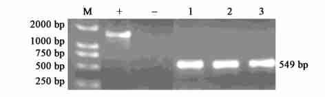 21212 05ZY0913 05ZY0936,(DNA ),, 2,,,4 PCR, :MRP,,; pset4s,, pset4s ;0913 B 0936 B 0913 C 0936 C,0913 0936 05ZY0913, 05ZY0936 05ZY 0913 05ZY 0936,PCR 5 6 MRP