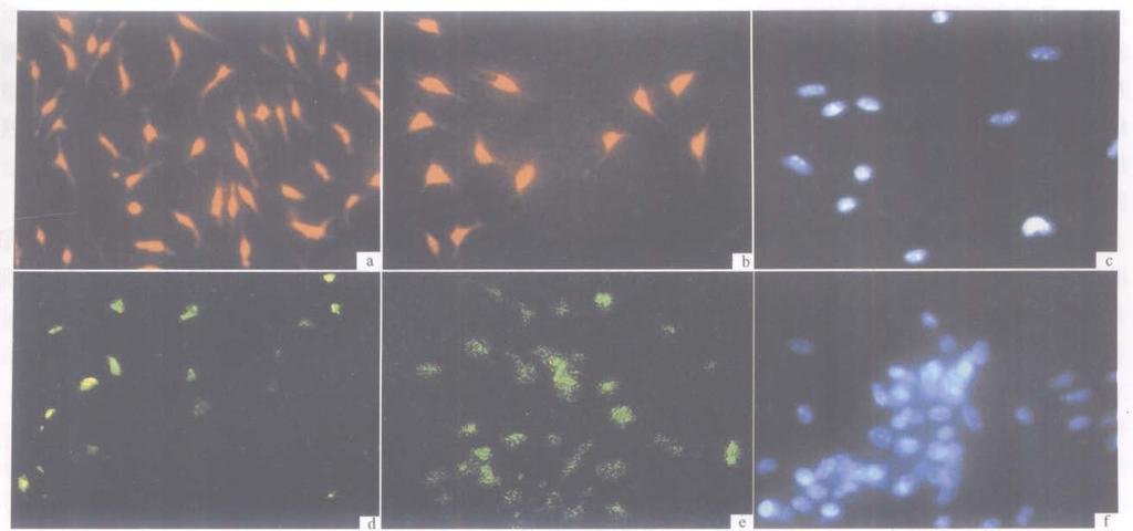 1 MSCs 233 a. 14 d Cy3 NF-200 b. MSCs Cy3 NF-200 c. 3 MSCs Cy3 NF-200 Hoechst 33258 Hoechst 33258 d. 14 d FITC NSE e. MSCs FITC NSE f. 3 MSCs Hoechst 33258 Hoechst 33258 Cy3 FITC Hoechst 33258 a.