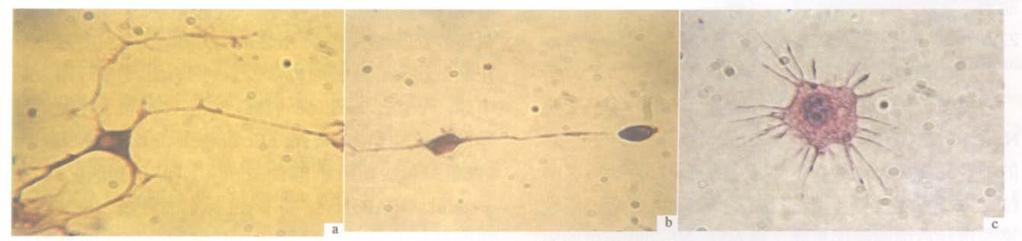 Sample, MSCs after neuron inducing were stained with antibodies against NF-200-Cy3; c.