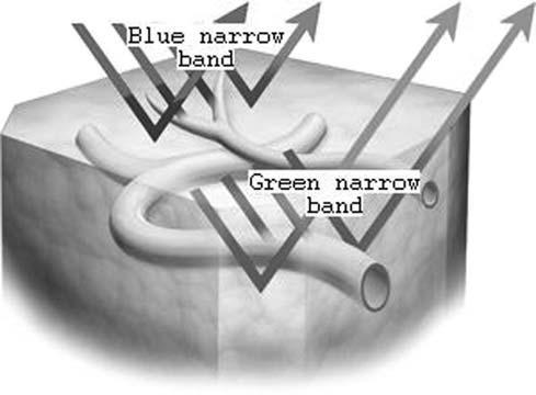 - blue narrow band(390-445 nm)