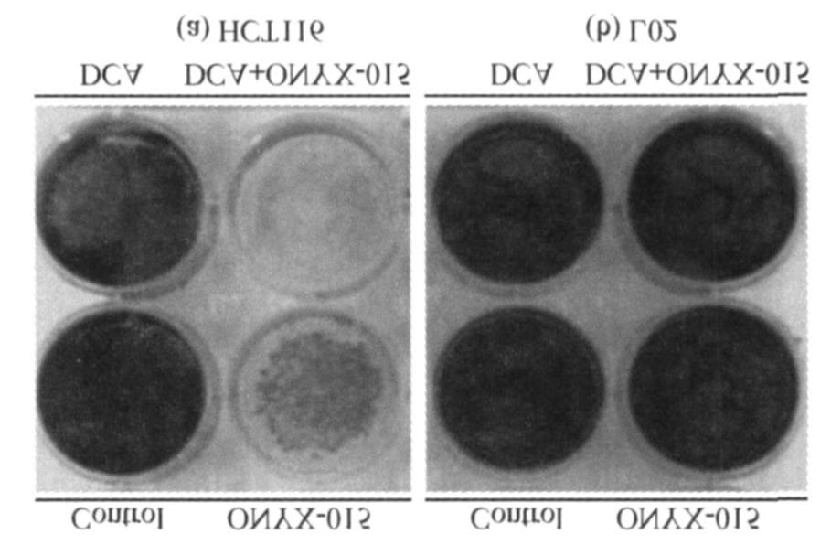 YX2015 (10 MO I) 5 d,,, ON YX2015 HCT116, ON YX2015