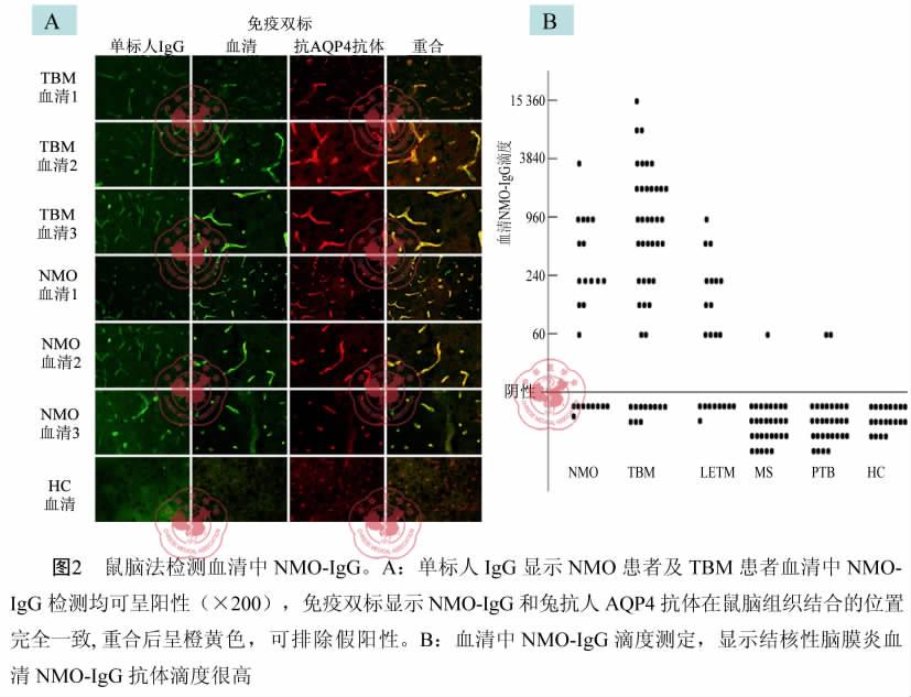 2150 2010 11 4 11 Chin J CliniciansElectronic EditionNovember 15 2010 Vol. 4 No. 11 420 ~ 490 nm GFP EGFP /HEK293 EGFP CY3 IgG 535 ~ 550 nm IIF AQP4 CY3 GFP AQP4 3 24 NMO 22 91. 7% 22 LETM 19 86.