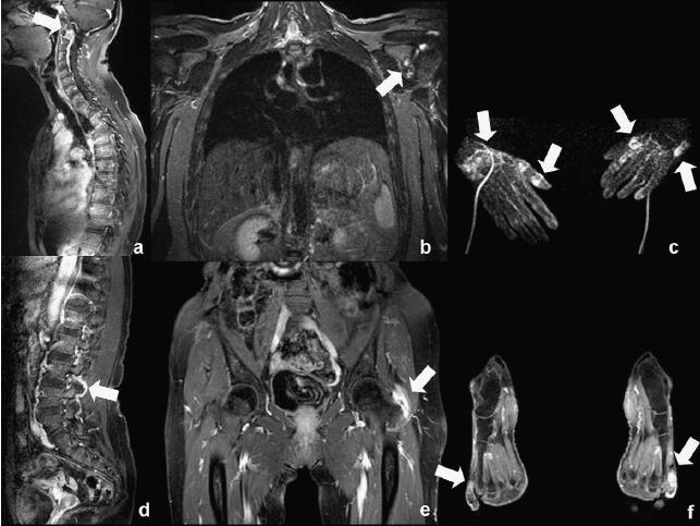 ΟΛΟΧΜΑΣΙΚH MRI