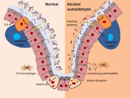 Εντερικό μικροβίωμα και αλκοολική ηπατική νόσος Szabo G.Gastroenterology.
