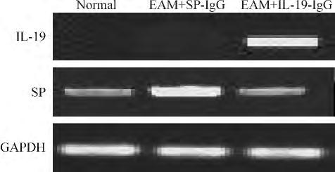746 EDs interventricular septal thicknessnatriuretic peptide ANP brain natriuretic IVS left ventricular posterior wall thickness LVPW left ventricular fractional shortening LVFS ejection frac- tions