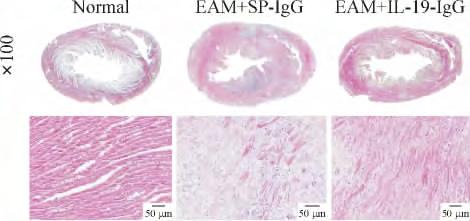 747 EAM + SP-IgG EAM + IL-19- IgG LVPW IVS LVEF LVFS 2 4 ANP BNP 17 RNA cdna PCR ANP BNP Figure 2. The histopathological images of the hearts with experimental autoimmune myocarditis EAM.