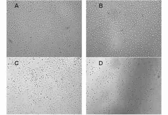 11 : (A549) PGC21 1061 2. 3 A549 PGC21 [3, 6 ]. A549 PGC21,.,,.,40 80 160 320 475 molπl, 115 % 712 % 1119 % 1219 % 1613 %, ; 80 molπl, ( P < 0105) (Fig. 3). Fig.