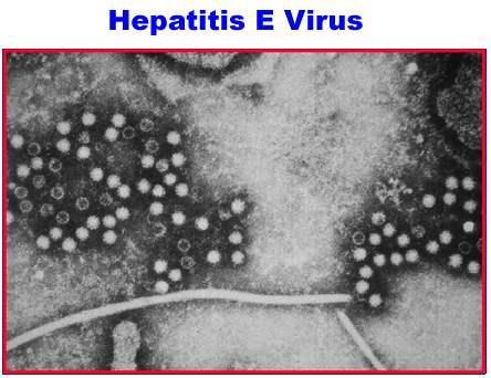 Γένος Hepevirus και αποτελεί το μοναδικό μέλος της οικογένειας Hepeviridiea.