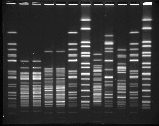 DNA εφαρμόζωντας ηλεκτρικό πεδίο, το οποίο