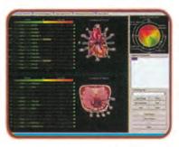 Glavne karakteristike softwera: - 12 odvoda za ECG sa interpretacijama - Vektorsku kardiografiju (VCG) sa interpretacijom - Elektronski lenjir za merenje EKG talasa - 3-D VCG animacija za
